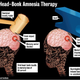 Secondary Head-Bonk Amnesia Therapy, bonk-impact point, coreresponding bonk-impact point.